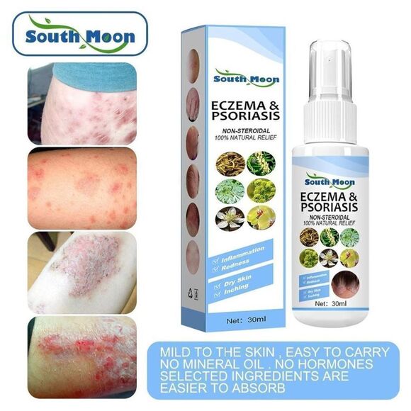 New Seborrheic Dermatitis Spray, Psoriasis Cream, Scalp Cream for Comfort and Re - Picture 4 of 7